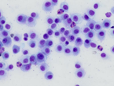 MCT-cytology